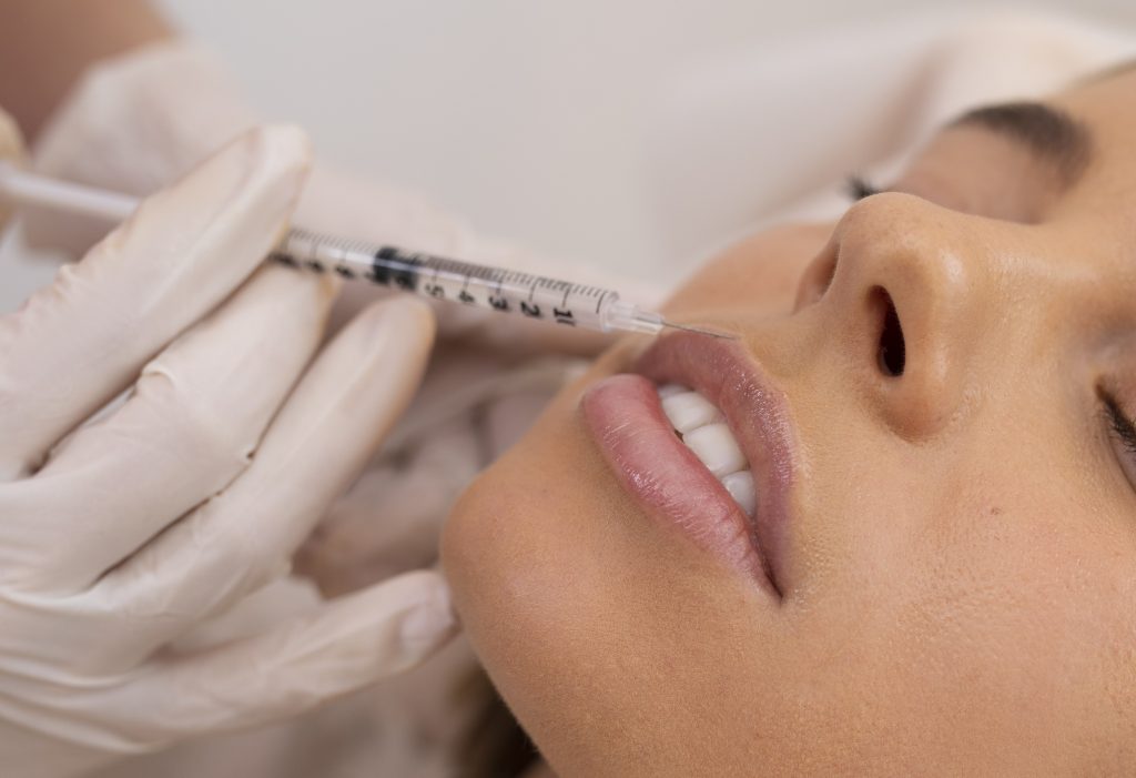 הגדלת שפתיים