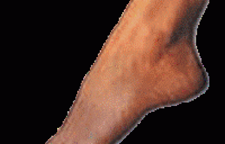 לטפל בכפות הרגליים