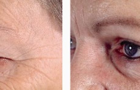 אני רואה לך בעיניים