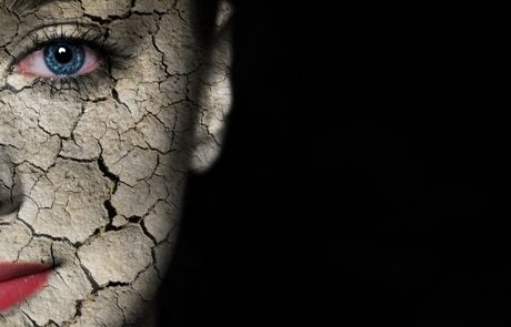 זהירות, פילינגים!