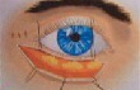 כירורגיה של המבט