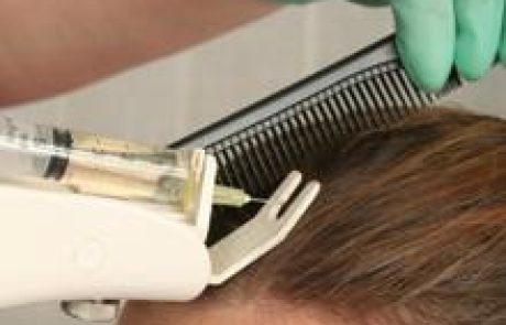 זריקות בראש