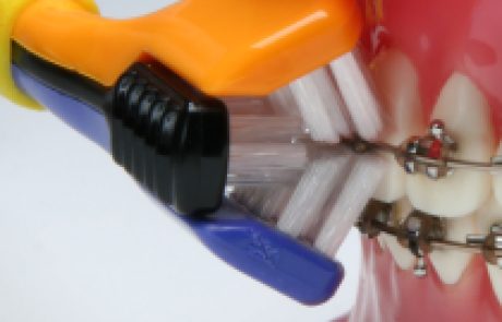 חיוך של מיליון דולר