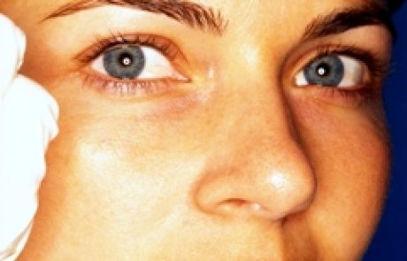 להיות צעיר לנצח, או: איך לנצח את הקמטים