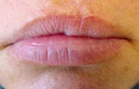 בשרות הרפואה