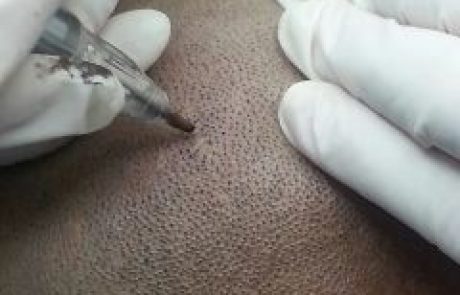 מיקרופיגמנטציה ואיפור קבוע