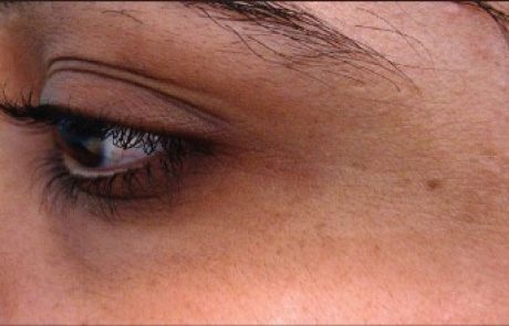 עיגולים שחורים