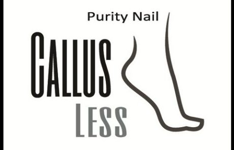 פנגס-לס ישראל: ממיס העור קאלוס לס