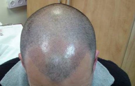 הדמיית שיער וטכניקת השערה באיפור קבוע