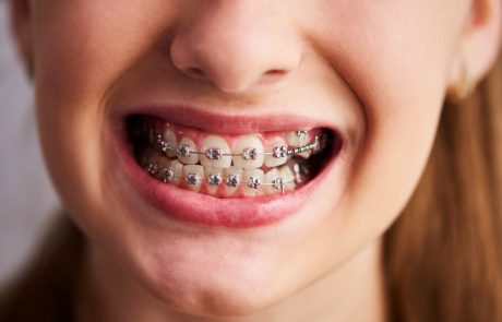 רפואת שיניים אסתטית – המדריך המלא