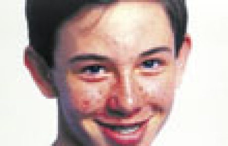 מתח נפשי ואקנה – קשר ההכרחי