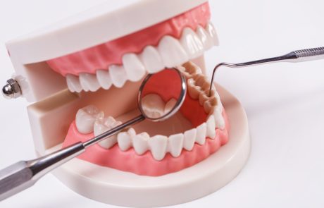 מחפשים טיפול יישור שיניים יעיל? מצאנו את הפתרון עבורכם