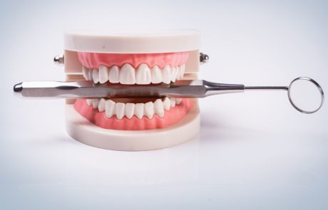 לפני השתלת שיניים? מה היתרונות והחסרונות של הטיפול