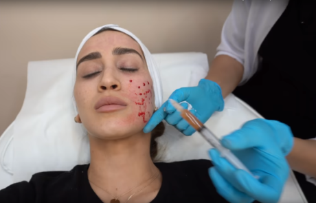 נוזל הנעורים